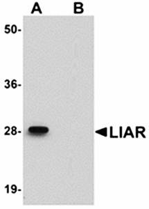 Western blot analysis of mouse kidney tissue lysate at 1 ug/mL in (A) the absence and (B) the presence of blocking peptide using LIAR antibody 