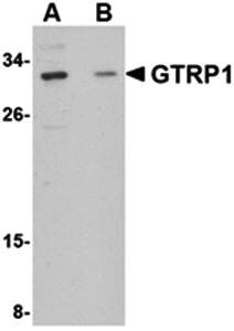 Western blot analysis of SK-N-SH cell lysate at 1 ug/mL in (A) absence and (B) presence of blocking peptide using GRTP1 antibody