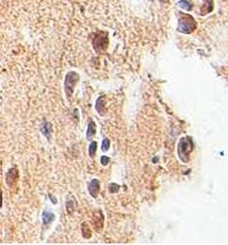 Immunohistochemical analysis of formalin-fixed paraffin embedded brain showing nuclear staining using Sp4 antibody 