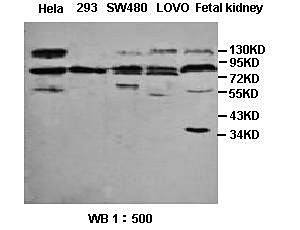  Western blot analysis of Hela,293,SW480,LOVO,fetal kidney lysates using Sp4 antibody