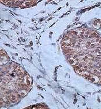 Immunohistochemical analysis of formalin-fixed paraffin embedded fetal testis staining using HORMAD2 antibody 