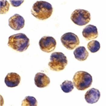  Immunohistochemical analysis of formalin-fixed and paraffin-embedded K562 cells using DOK1 antibody