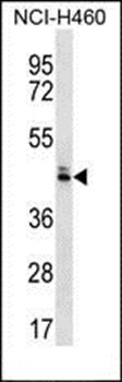 Western blot analysis of NCI-H460 cell line lysates (35ug/lane) using OR52N5 antibody (C-term)