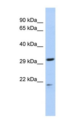 Western blot analysis of Jurkat cell lysate tissue using C14orf80 antibody