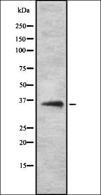 Western blot analysis of K562 whole cell lysates using OR52H1 antibody