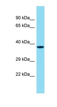 Western blot analysis of human HepG2 tissue using C14orf79 antibody
