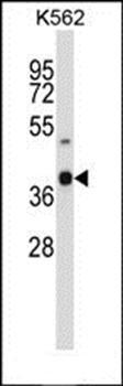 Western blot analysis of K562 cell line lysates (35ug/lane)using OR52H1 antibody (primary antibody dilution at: 1:1000)