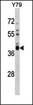 Western blot analysis of Y79 cell line lysates (35ug/lane) using OR52L1 (C-term) antibody