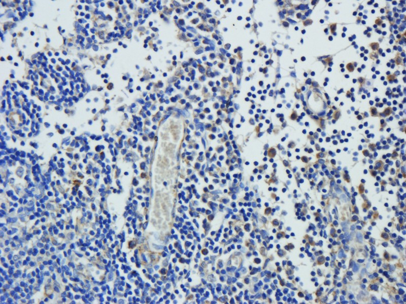 Immunohistochemical staining of paraffin embedded rat bladder tissue using anti-Leptin receptor (2.5 ug/ml)