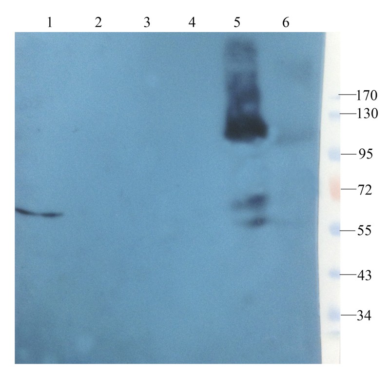 Western blot analysis of mouse liver (lane 1), mouse small intestines (lane 2), rat ovary (lane 3), rat brain (lane 4), ovarian cancer (lane 5), breast cancer (lane 6) using Leptin receptor (1 ug/ml)