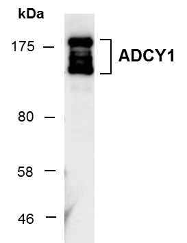 Western blot of total cell extracts from mouse brain using ADCY1 antibody