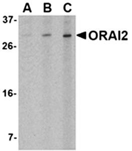 Western blot analysis of Jurkat cell lysate at (A) 1, (B) 2 and (C) 4 ug/mL using ORAI2 antibody