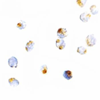 Immunohistochemical analysis of formalin-fixed and paraffin-embedded Jurkat cells at 5 ug/mL using ORAI2 antibody