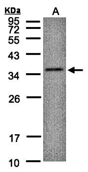 Western Blot analysis of A:HepG2 whole cell lysate using C17orf25 antibody