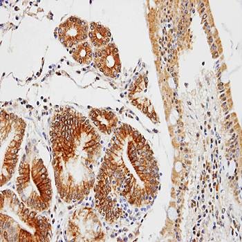 Immunohistochemical analysis of formalin-fixed and paraffin-embedded gastric using C17orf25 antibody