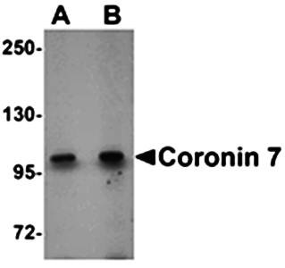 Western blot analysis of rat lung tissue lysate at (A) 1 and (B) 2 ug/mL using Coronin 7 antibody