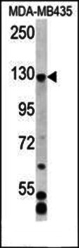 Western blot analysis in MDA-MB435 cell line lysates using C7orf63 antibody