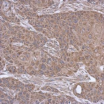Immunohistochemical analysis of formalin-fixed and paraffin-embedded Cal27 xenograft using SUCLA2 antibody