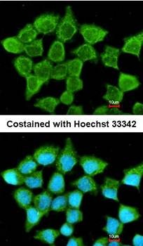 Confocal immunofluorescence analysis of methanol-fixed A431 using SUCLA2 antibody