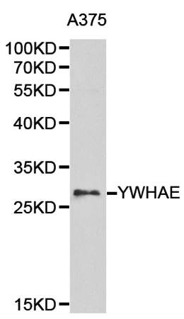 Western blot analysis of A375 cell line lysates using YWHAE antibody
