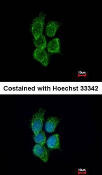 Confocal immunofluorescence analysis of methanol-fixed A431 using GALNT7 antibody
