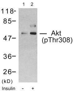 Western blot analysis using Akt (phospho-Thr308) antibody: Lane1: The extract from 293 cells untreated; Lane 2: The extract from 293 cells treated with insulin