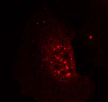Immunofluorescence staining of methanol-fixed HeLa cells showing nuclear dot staining using Akt (phospho-Thr308) antibody