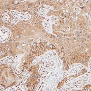 Immunohistochemical analysis of formalin-fixed and paraffin-embedded SCC15 xenograft using FAST antibody