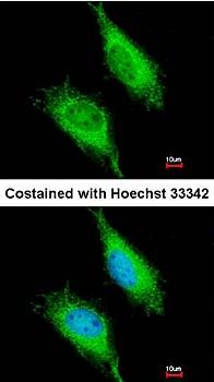 Confocal immunofluorescence analysis of methanol-fixed HeLa using FAST antibody