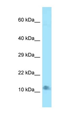 Western blot analysis of mouse Heart tissue using Lamtor4 antibody