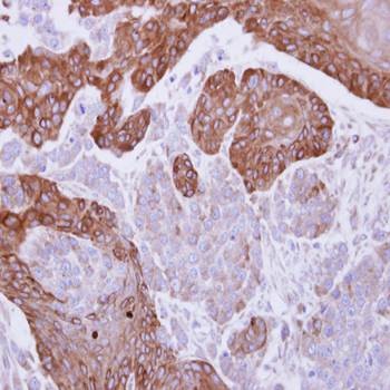 Immunohistochemical analysis of formalin-fixed and paraffin-embedded SG xenograft using FGD4 antibody