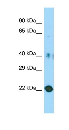 Western blot analysis of human HT1080 tissue using C11orf34 antibody