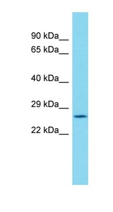 Western blot analysis of human Placenta tissue using C19orf52 antibody