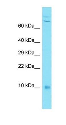 Western blot analysis of human MDA-MB-435S tissue using C7orf49 antibody