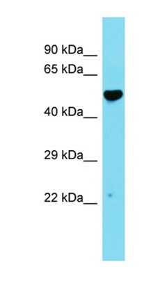 Western blot analysis of human Fetal heart tissue using C14orf166B antibody