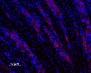 Expression of GALR1 in DRG Immunohistochemical staining of rat dorsal root ganglia (DRG) frozen section using Anti-Galanin Receptor Type 1 antibody (#WGA1017), (1:200), (red). Galanin Receptor is expressed in DRG neuron cells. Hoechst 33342 is used as the counterstain (blue).