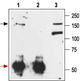 Immunoprecipitation of rat brain lysate: 1. Cell lysate + protein A beads + Anti-mGluR1 (extracellular) antibody (#WGA1270). 2. Cell lysate + protein A beads + pre-immune rabbit serum. 3. Cell lysate.