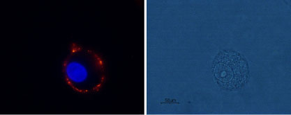 Expression of mGluR1 in rat C6 glioma cells Immunocytochemical staining of live intact rat C6 glioma cells using Anti-mGluR1 (extracellular) antibody (#WGA1270), (1:100), followed by goat-anti-rabbit-AlexaFluor-555 secondary antibody (red). Nuclei were stained with Hoechst 33342 (blue).
