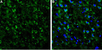 Expression of mGluR7 in rat neocortex Immunohistochemical staining of rat neocortex frozen sections using Anti-mGluR7 (extracellular) antibody (#WGA1254). A. mGluR7 staining (green) appears in several neocortical neurons. B. Merge image showing mGluR7 staining together with cell nuclei (blue).