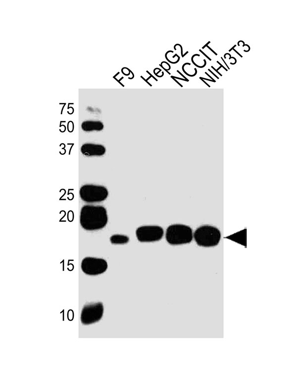 All lanes : Anti-Hmga2 Antibody (C-term) at 1:1000 dilution Lane 1: F9 whole cell lysates Lane 2: HepG2 whole cell lysates Lane 3: NCCIT whole cell lysates Lane 4: NIH/3T3 whole cell lysates Lysates/proteins at 20 µg per lane. Secondary Goat Anti-Rabbit IgG, (H+L),Peroxidase conjugated at 1/10000 dilution Predicted band size : 12 kDa Blocking/Dilution buffer: 5% NFDM/TBST.