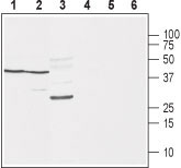 Western blot analysis of rat brain (lanes 1 and 4), mouse brain (lanes 2 and 5) and rat skeletal muscle (lanes 3 and 6): 1-3. Anti-Na V β 1 (extracellular) antibody (#WGA1238), (1:400). 4-6. Anti-Na V β 1 (extracellular) antibody, preincubated with the control peptide antigen.