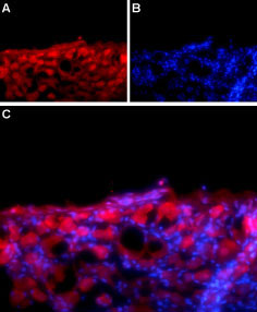 Expression of Na V β1 in rat DRG Immunohistochemical staining of adult rat dorsal root ganglion (DRG) using Anti- Na V β 1 (extracellular) antibody (#WGA1238) followed by goat anti-rabbit-AlexaFluor-594 secondary antibody. A. Na v β1 labeling (red) appears in the cell bodies of the DRG neurons. B. Nuclear staining using DAPI as the counterstain (blue). C. Merged image of A and B.