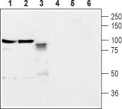 Western blot analysis of rat brain membrane (lanes 1 and 4), mouse brain membrane (lanes 2 and 5) and rat PC-12 cells (lanes 3 and 6): 1-3. Anti-Neuroligin 2 (extracellular) antibody (#WGA1244), (1:400). 4-6. Anti-Neuroligin 2 (extracellular) antibody preincubated with the control peptide antigen.