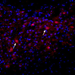 Expression of nAChR α2 in rat deep cerebellar nucleus Immunohistochemical staining of immersion-fixed, free floating rat brain frozen sections using Anti-Nicotinic Acetylcholine Receptor α2 (extracellular) antibody (#WGA1245), (1:100). Staining reveals expression of nAChRα2 (red) in cells with neuronal outline (arrows point at some examples) in the red nucleus. DAPI is used as the counterstain (blue).