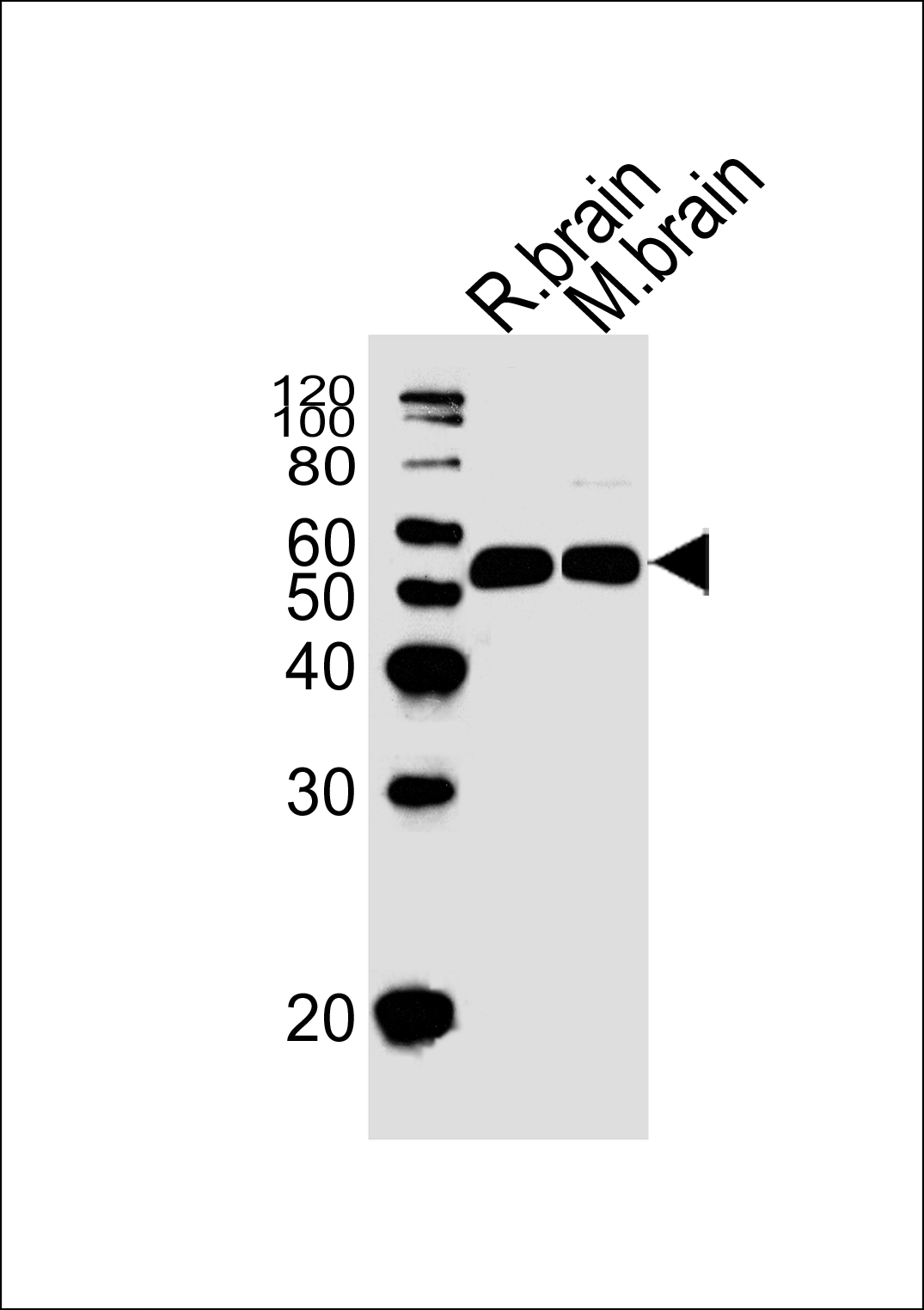 Western blot analysis of lysates from rat brain and mouse brain tissue lysate(from left to right),using Sstr1 Antibody(Cat. #WGA1279). WGA1279 was diluted at 1:1000 at each lane. A goat anti-rabbit IgG H&L(HRP) at 1:5000 dilution was used as the secondary antibody.Lysates at 35ug per lane.