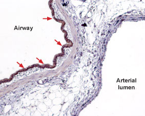 Expression of Sphingosine 1-Phosphate Receptor 2 in rat lung Immunohistochemical staining of paraffin embedded rat lung sections using Anti-Sphingosine 1-Phosphate Receptor 2 antibody (#WGA1006), (1:100). Sphingosine 1-Phosphate Receptor 2 is expressed in respiratory epithelium (red arrows). Hematoxilin is used as the counterstain.