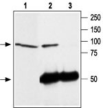 Immunoprecipitation of rat brain lysate: 1. Rat brain lysate. 2. Lysate immunoprecipitated with Anti-TRPC4 antibody (#WGA1146), (6 mg). 3. Lysate immunoprecipitated with pre-immune rabbit serum. The upper arrow indicates the TRPC4 channel while the lower arrow indicates the IgG heavy chain. Western blot analysis was performed with Anti-TRPC4 antibody.