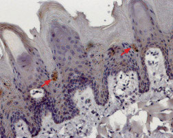 Expression of TRPM5 in rat tongue Immunohistochemical staining of rat tongue paraffin embedded sections using Anti-TRPM5 antibody (#WGA1142), (1:100). TRPM5 is expressed in discrete groups of cells deep in the sulcus of the papillae. Hematoxilin is used as the counterstain.
