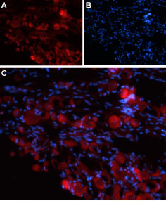 Expression of TRPV4 in rat DRG Immunohistochemical staining of rat dorsal root ganglion (DRG) frozen sections using Anti-TRPV4 (extracellular) antibody (# WGA1246). A. TRPV4 labeling appears in neuronal cell bodies. B. Nuclear staining using DAPI as counter stain. C. merged images of A and B.