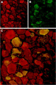 Expression of TRPV4 in rat DRG Immunohistochemical staining of rat dorsal root ganglion (DRG) frozen sections using Anti-TRPV4 antibody (#WGA1235). A. TRPV4 (red) in DRG neurons. B. Staining with mouse anti-Parvalbumin (green) in the same DRG section. C. Confocal merge of TRPV4 and Parvalbumin demonstrates colocalization.